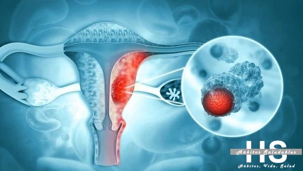 Cáncer Cervicouterino: Cuida tu Salud y Fortalece tu Sistema Inmunológico