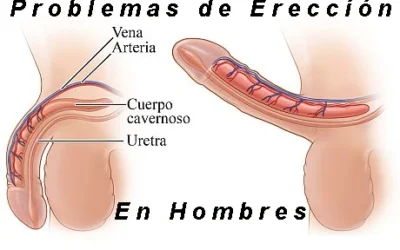 Problemas de Erección en Hombres Jóvenes: Causas y Soluciones